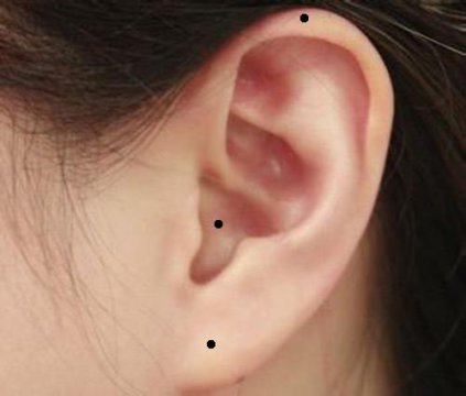耳朵后面有痣代表什么